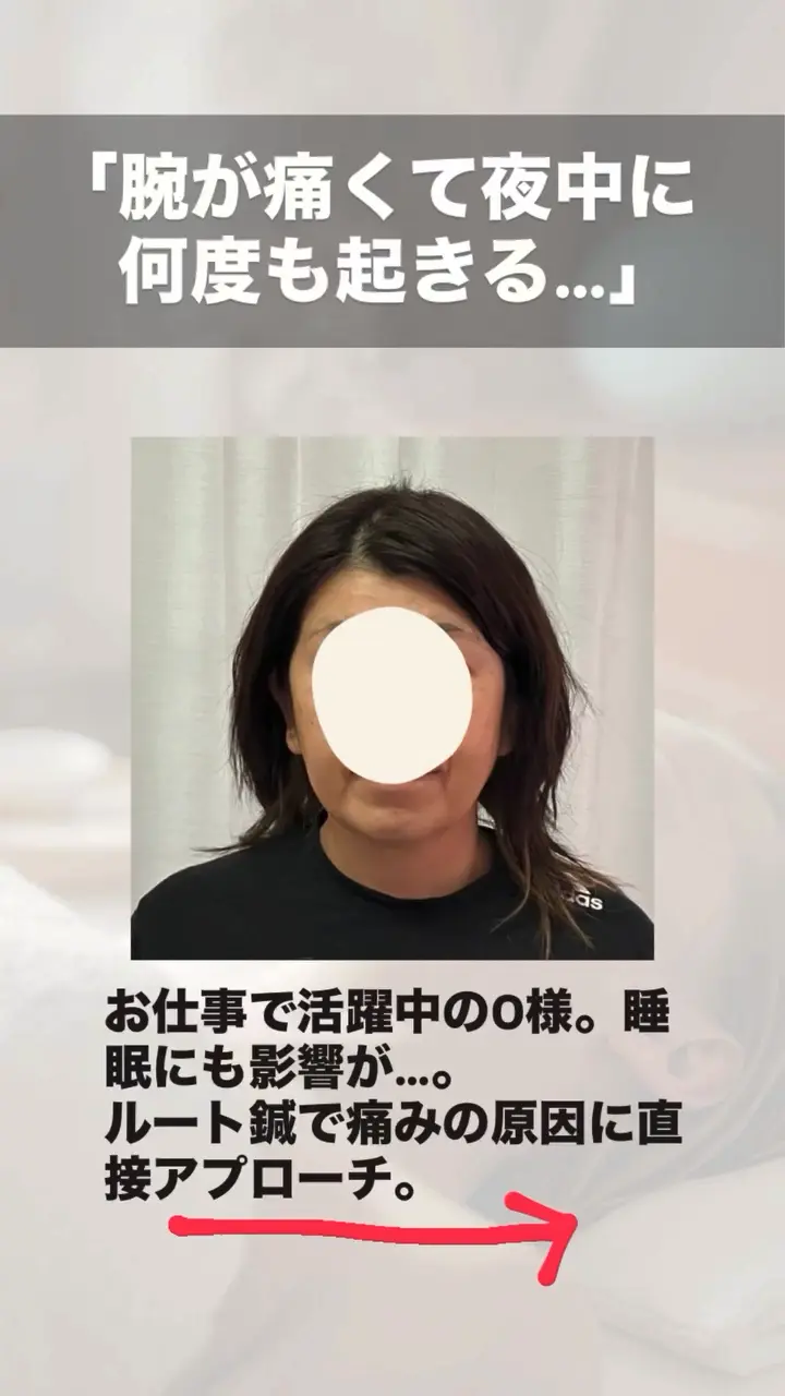 鬼美容鍼 不調改善のビフォーアフター 施術前