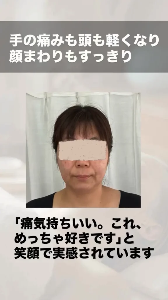 鬼美容鍼 不調改善のビフォーアフター 施術後